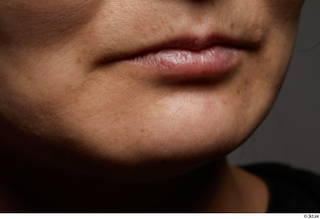   Photos Chiziwa Homugi HD Face skin references lips mouth pores skin texture 0007.jpg